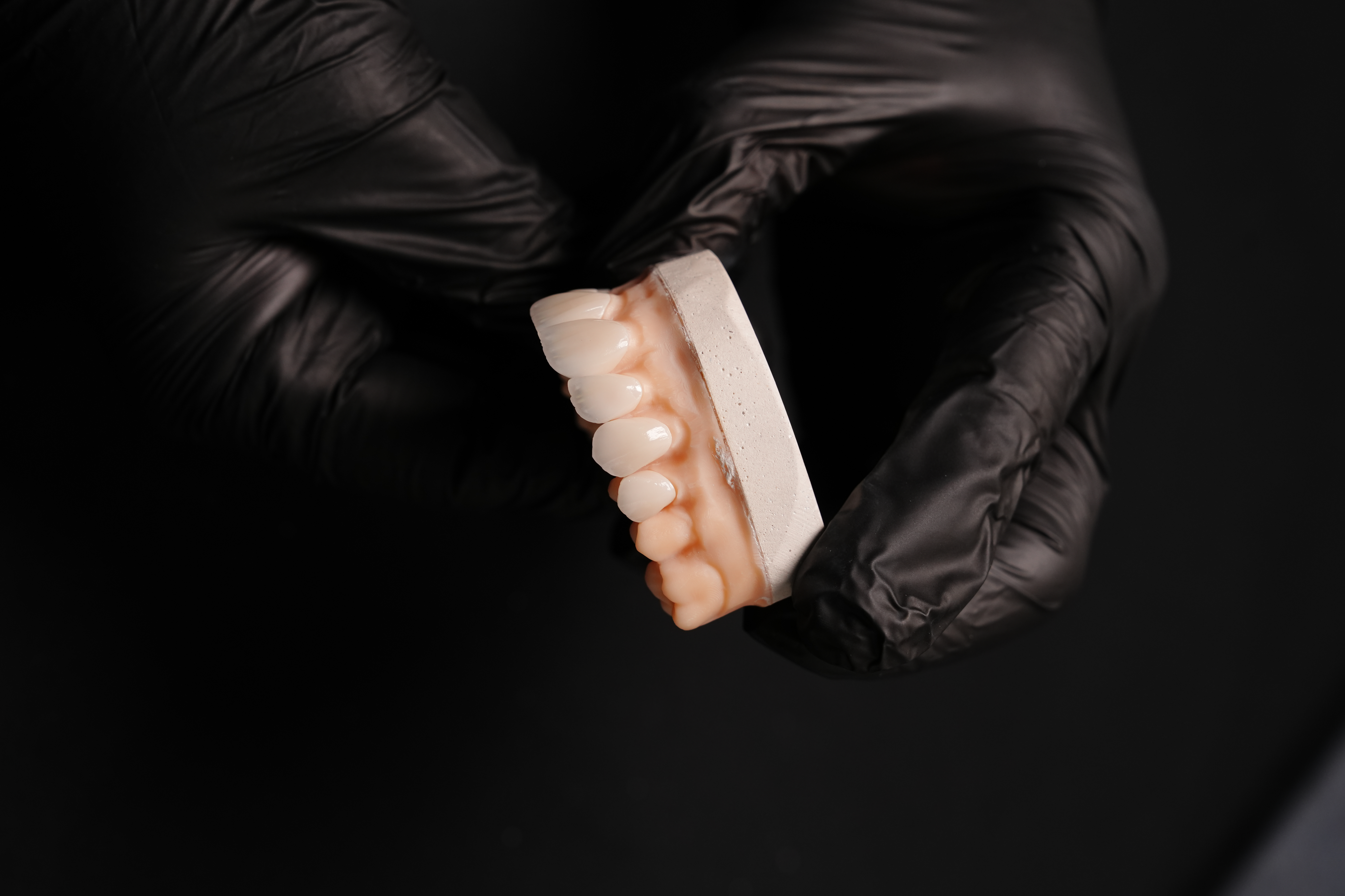 CAD CAM dentistry